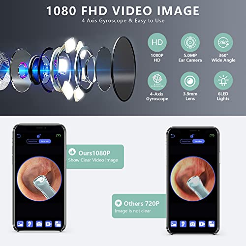 Ear Wax Removal, Ear Cleaner, Earwax Remover Tool with 1080P FHD, Wireless En...