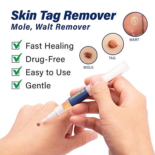 Skin Tag Remover, Advanced New Wart Remover, Quickly, Safe and Gentle, Suitab...