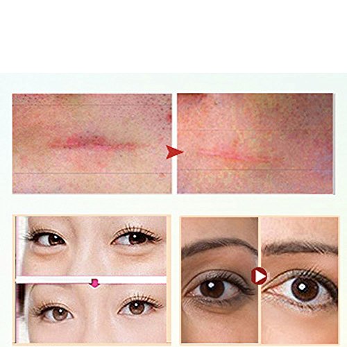 Acne Wrinkle Anti-Aging Exfoliating Skin Health Care Massage Relaxation Devic...