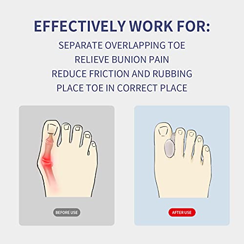 Zinyakon Silicone Toe Separators, 12 Packs of Gel Toe Spacers for Men and Wom...