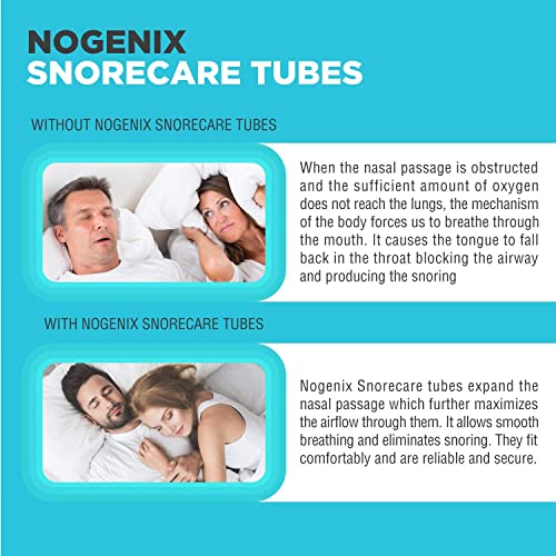 Zircon Set of 4 Nose Vents to Ease Breathing - Anti Snoring - No Side Effects...