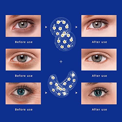 Gel Ice Pack Reusable Cooling Eye Pads and Under Eye Patches,Eye Hot Cold Tre...