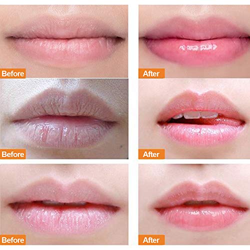 Lip Sleeping Mask, with Lip Scrubs Exfoliator & Moisturizer, Double Effect Li...