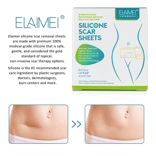 Medical Grade Silicone Scar Sheet, Silicone Scar Tape (1.6”x 60”), Scar Remov...