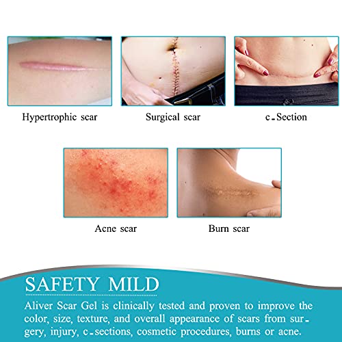 Silicone Scar Sheet (1.6” x 120”), Medical Grade Scar Tape Scar Removal For K...