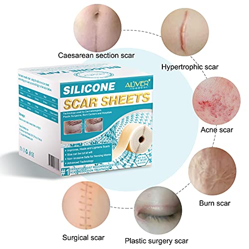 Silicone Scar Sheet (1.6” x 120”), Medical Grade Scar Tape Scar Removal For K...