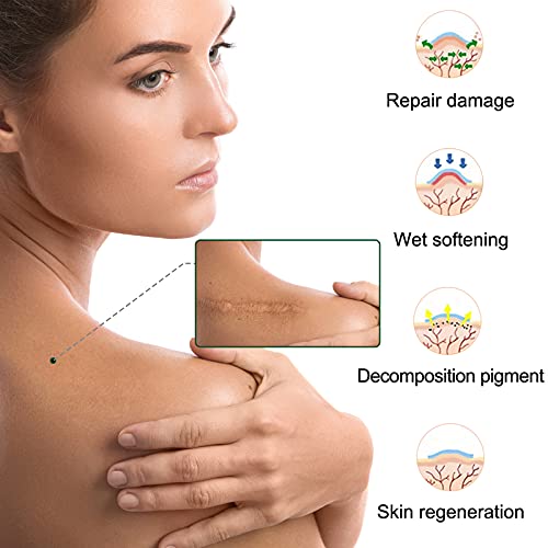 Silicone Scar Sheet (1.6” x 120”), Medical Grade Scar Tape Scar Removal For K...