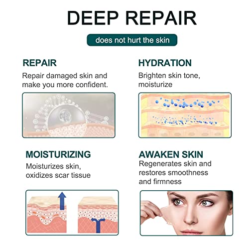 Silicone Scar Sheets (1.6” x 120”Roll-3M), Silicone Scar Tape Roll, Scar Sili...