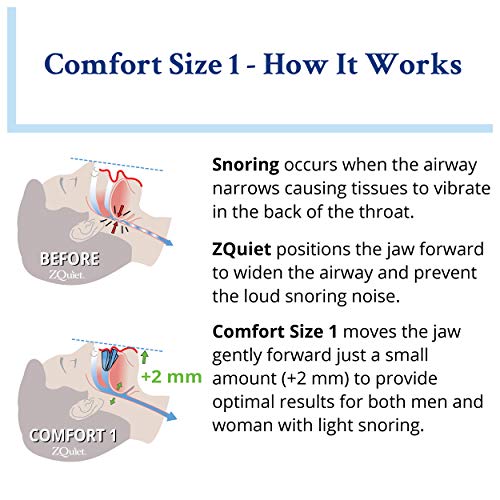 ZQuiet Anti-Snoring Mouthpiece Solution - Comfort Size #1 (Single Device) - M...