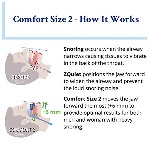 ZQuiet Anti-Snoring Mouthpiece Solution - Comfort Size #2 (Single Device) - M...